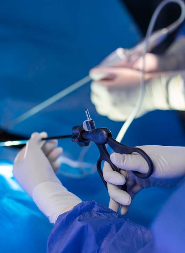 LAPAROSCOPIA PARA CANCER DE PROSTATA LAPAROSCOPIA PARA CANCER DE PROSTATA