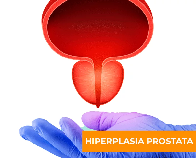 QUE ES LA PROSTATA